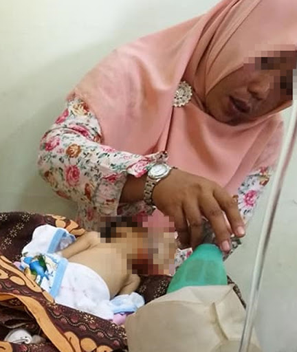 Em bé bị chảy máu ở miệng và mũi sau khi bị bà cho ăn cháo chuối. Ảnh: The Asian Parent.